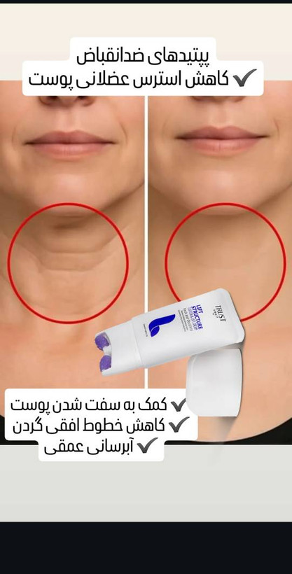 کرم سفت کننده و لیفت کننده گردن و دکلته تراست اسمارت